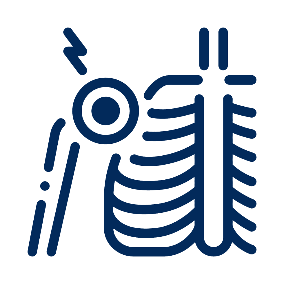shoulder-arthritis iacon