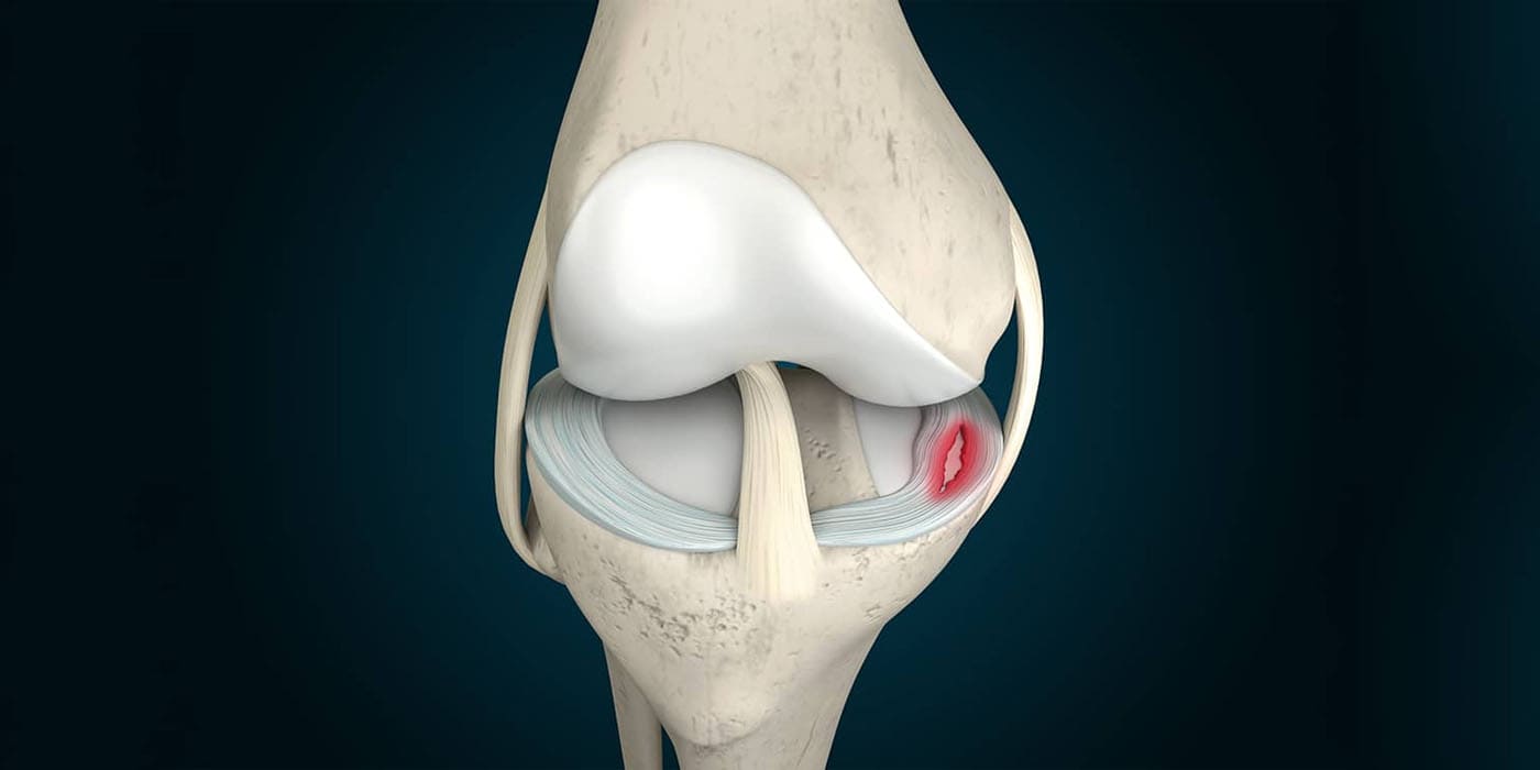 meniscus-injury